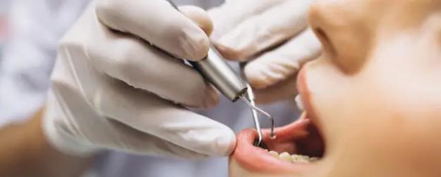 Зубная боль для кошелька: где в России дешевле всего лечить зубы