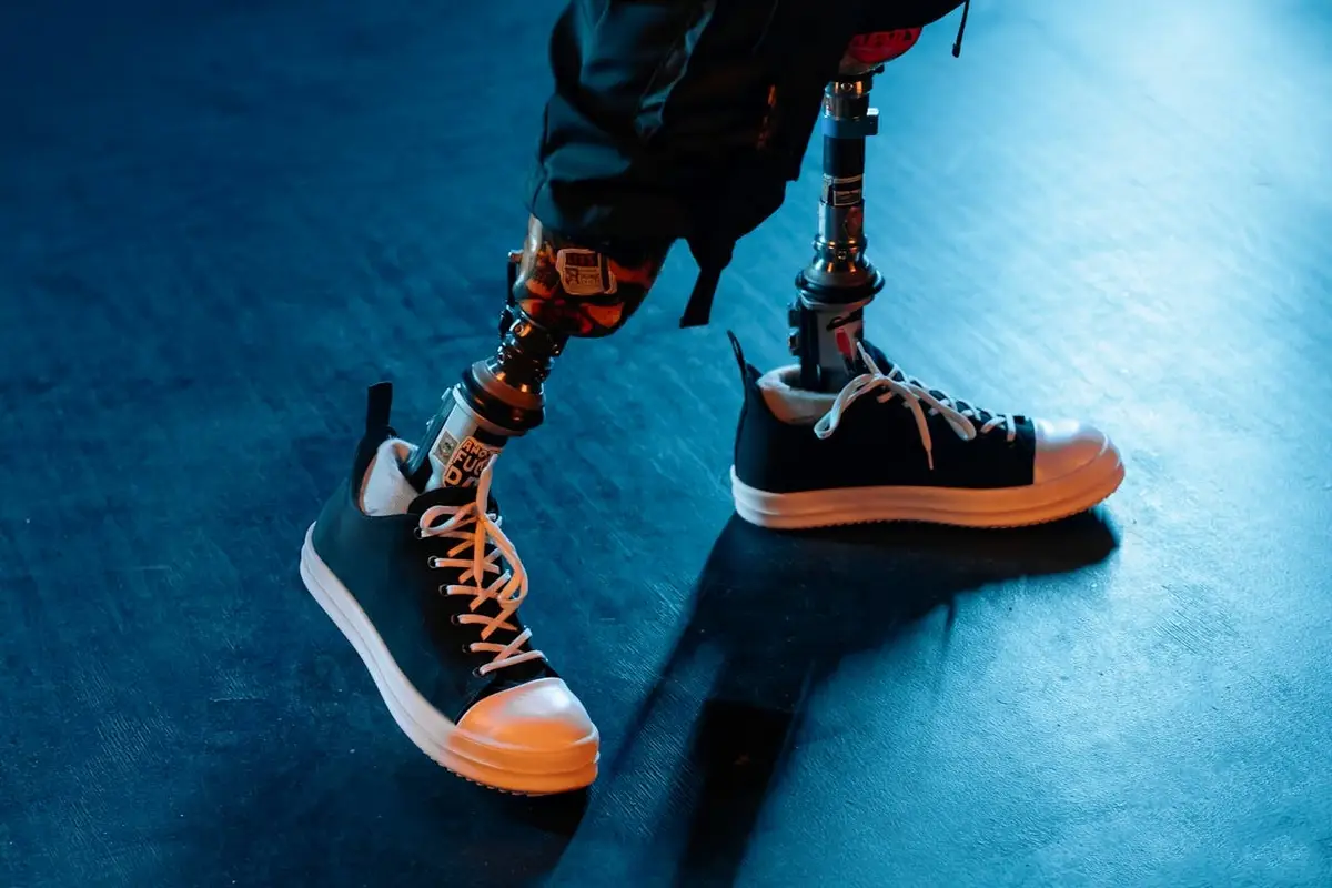 Немецкий гигант Adidas скатился до максимальных убытков